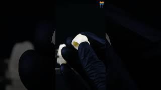 iDENTical Root Canal Model M4012 - Transparent Teaching Aid for Dental Education #shortsviral