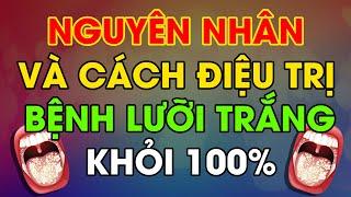 Bệnh Lưỡi Trắng (Tưa Lưỡi) - Nguyên Nhân và Cách Điều Trị