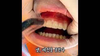 라미네이트 얼마나 예뻐지는지 미리 아는 방법!