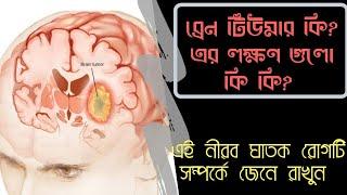 জেনে রাখুন ব্রেইন টিউমারের লক্ষণ সমূহ।||  symptoms of brain tumor || Alok Roy topu|| 