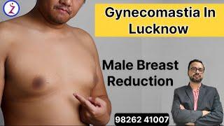 Gynecomastia In Lucknow | Gynecomastia Surgery In Lucknow | Male Boobs Surgery, Zenith Clinic