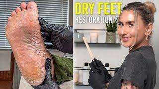 Restoring Dry Cracked Feet And Heels (SATISFYING)