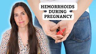 Hemorrhoids During Pregnancy  Natural Remedies