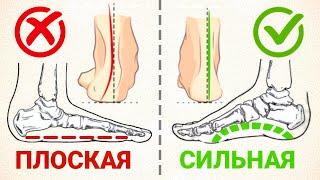 Исправь ВАЛЬГУС и ПЛОСКОСТОПИЕ с помощью одного комплекса упражнений