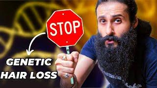 Stop Blaming Your Genetics For Hair Loss - Fix This Instead | Bearded Chokra