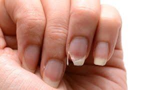 How to Grow Strong Healthy Nails Fast: 5 Simple Tips