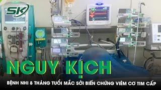 Bệnh nhi 8 tháng tuổi nguy kịch mắc sởi biến chứng viêm cơ tim cấp | SKĐS