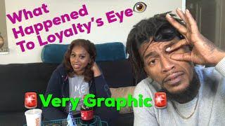 We Answer Your #1 Question: What Happened To Loyalty’s Eye ***VeryGraphic**