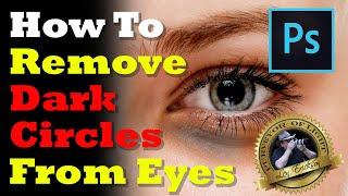 How to Remove Dark Circles Under Eyes Natural Effect