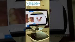 smile sculptors primescan