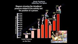 Body Positions Affecting The Disc Pressure - Everything You Need To Know - Dr. Nabil Ebraheim