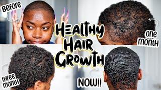 PCOS & ALOPECIA SUFFERERS THIS Is How I DOUBLED My Hair Growth Using 2 METHODS!! | Laurasia Andrea