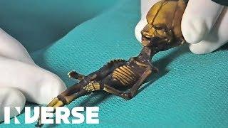 Atacama Skeleton Is A Mutant, Not An Alien | Inverse