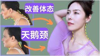 如何练出修长天鹅颈？矫正脖子前倾&驼背 | 改善体态 【Tips to Elongate the Neck】