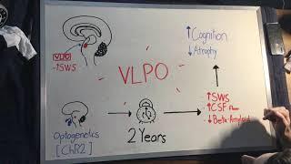 VLPO Modulation to Improve Alzheimer's Disease Symptomology