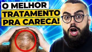 QUAL MELHOR TRATAMENTO PARA QUEDA DE CABELO MASCULINO?