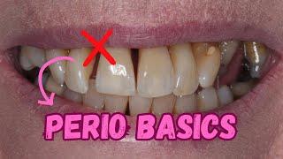 Periodontics for Beginners - PS008