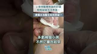 醫生如何弄破燙傷水泡？會痛嗎？#shorts #水泡 #皮膚科