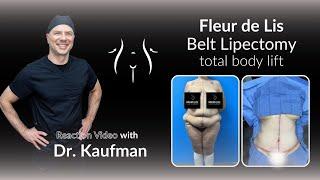  Jaw-Dropping Fleur de Lis Belt Lipectomy Transformation  | Plastic Surgery Reaction