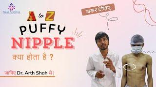 Puffy Nipple: Learn everything about a Complete Guide by Plastic Surgeon Dr. Arth Shah