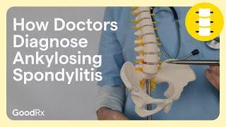 4 Things Doctors Look For When Diagnosing Ankylosing Spondylitis | GoodRx