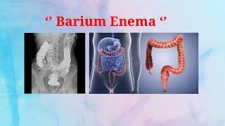 Barium Enema ( Large Intestine Study )