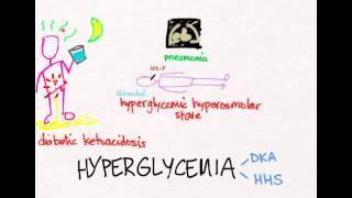 Hyperglycemia 1