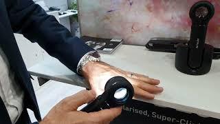 How to use the DermLite DL5 Dermatoscope