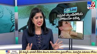 Cervical Spondylosis: Causes, Symptoms, and Treatment || Life Line - TV9