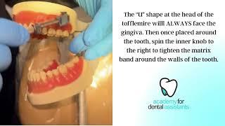 Assembling and Place Matrix Band & Tofflemire Retainer - Academy for Dental Assistants