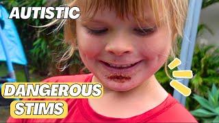 HUGE MILESTONE & Stimming Injuries *OUCH* | Aussie Autism Family