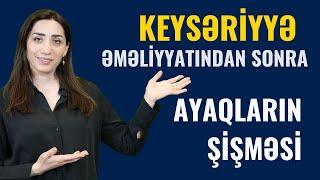 KEYSƏRİYYƏ ƏMƏLİYYATINDAN sonra NƏLƏRƏ DİQQƏT ETMƏLİYİK? | Ginekoloq Vüsalə Əzizova