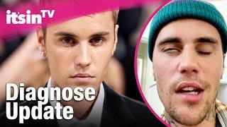 Justin Bieber gibt Gesundheitsupdate | It's in TV