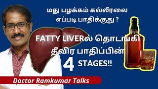 How Alcohol damage liver? 4 stages of damage starts from FATTY LIVER! குடிப்பழக்கம் & கல்லீரல்!