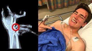 how TechSmartt SHATTERED his hand