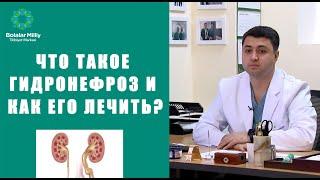 Что такое ГИДРОНЕФРОЗ и как его лечить?