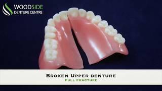 Denture Repair in  Airdrie, AB | Woodside Denture Centre