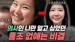 안면홍조 주사피부염 없애는 방법 "의사가 직접 효과본 홈케어 꿀팁 알려드려요!!" 피부과 맨날 다녀도 효과없었다면, 이렇게 해보세요 #주사피부염 #안면홍조