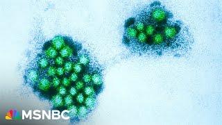 What to know about the highly-contagious norovirus surge