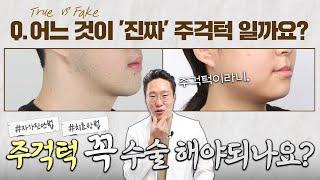 수술하지 않아도 되는 주걱턱이 있다? (Feat.가짜 주걱턱 구별법 공개)