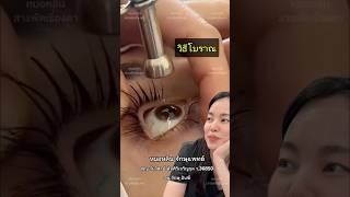 วิธีโบราณ #หมอหลิน #หมอตา #จักษุแพทย์ #สารพัดเรื่องตา #โรงพยาบาลอินซ์ #โรคตา #ศัลยกรรมตา