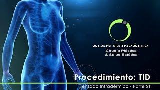 Procedimiento TID [Tensado Intradérmico] - Parte 2 - Alan González