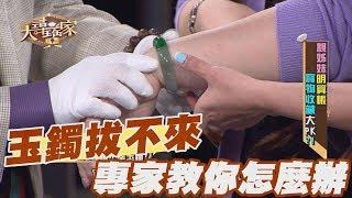 【精華版】玉鐲拔不下來 專家教你怎麼辦