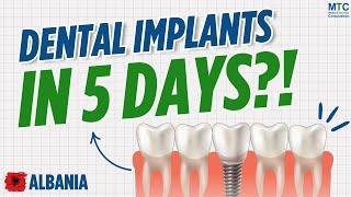 Dental Implants in Albania: What to Expect During Your Visit