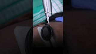 Pigmentation Treatment on Face‍️ by Dermatologist || Dr. Priyanka Reddy || DNA Skin Clinic ||