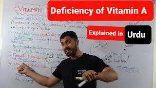 L-31 Deficiency Of  Vitamin A explained in Urdu by Dr Hadi