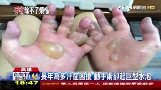 治手汗起巨型水泡　病患控醫師醫療不當