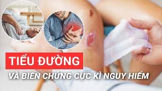 Tiểu đường biến chứng cực kỳ nguy hiểm| BS Võ Hà Băng Sương - Vinmec Phú Quốc