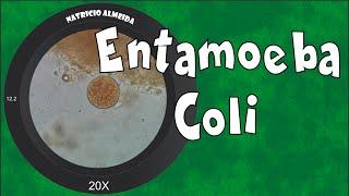 Entamoeba coli - como reconhecer e diferenciar de Entamoeba histolytica