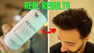 Well THIS was a surprise ... Using Revita Extra-Strength High Density Shampoo from DS Laboratories